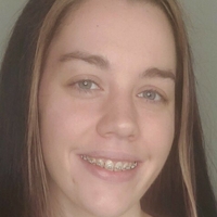 bracefacefree Nagie