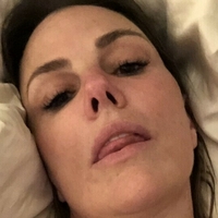 Dysmorphia_wb Nagie