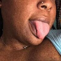 freckledfantasy5 Nagie