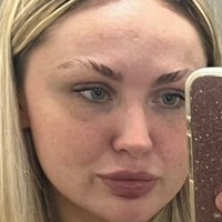 Katysof Nagie