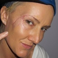 Keala Kennelly Nagie