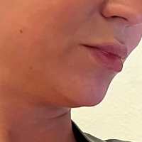 misslobatox Nagie