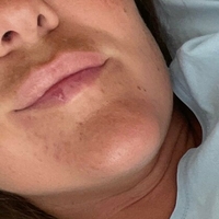 naughty_katarina_free Nagie