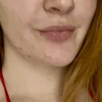 SophieLouise Nagie