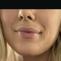 Wettmelons Nagie